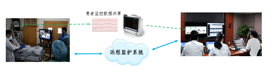 远程看护视频系统